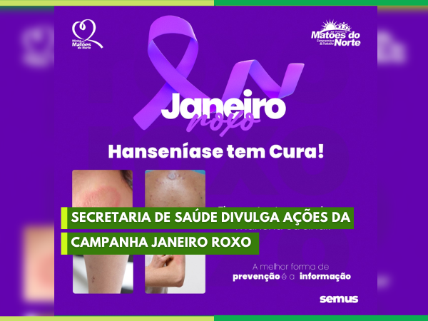 Secretaria de Saúde divulga ações da campanha Janeiro Roxo